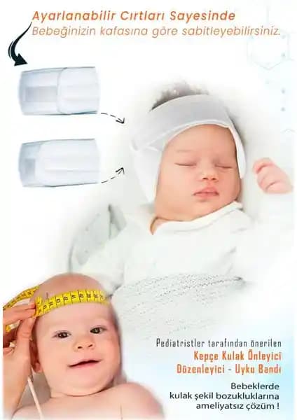 Urz Store Bebek Kepçe Kulak Bandı: Doğal ve Güvenli Kulak Şekillendirme Çözümü